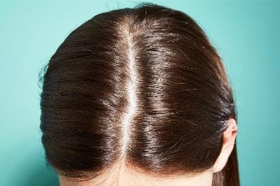 Клопы не кусают людей там где есть волосы потому что в этих местах им сложно передвигаться